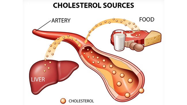 Cholesterol dư thừa gây cản trở quá trình lưu thông máu 